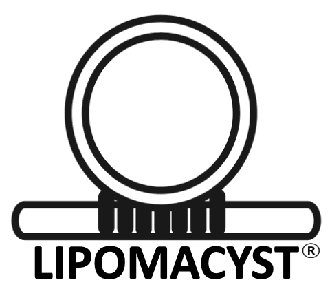 LipomaCyst