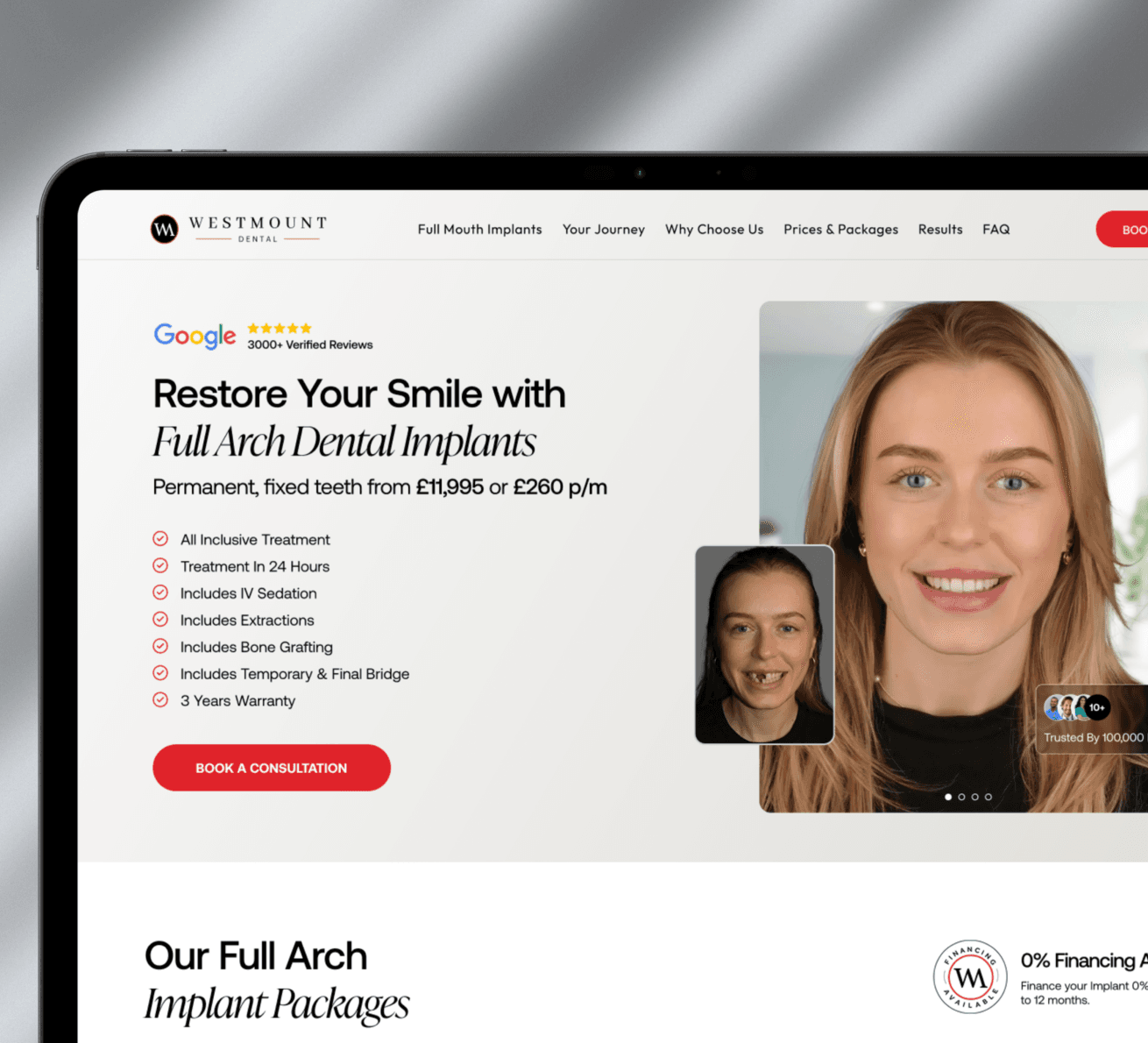 Westmount Dental: Dental implant consultation page