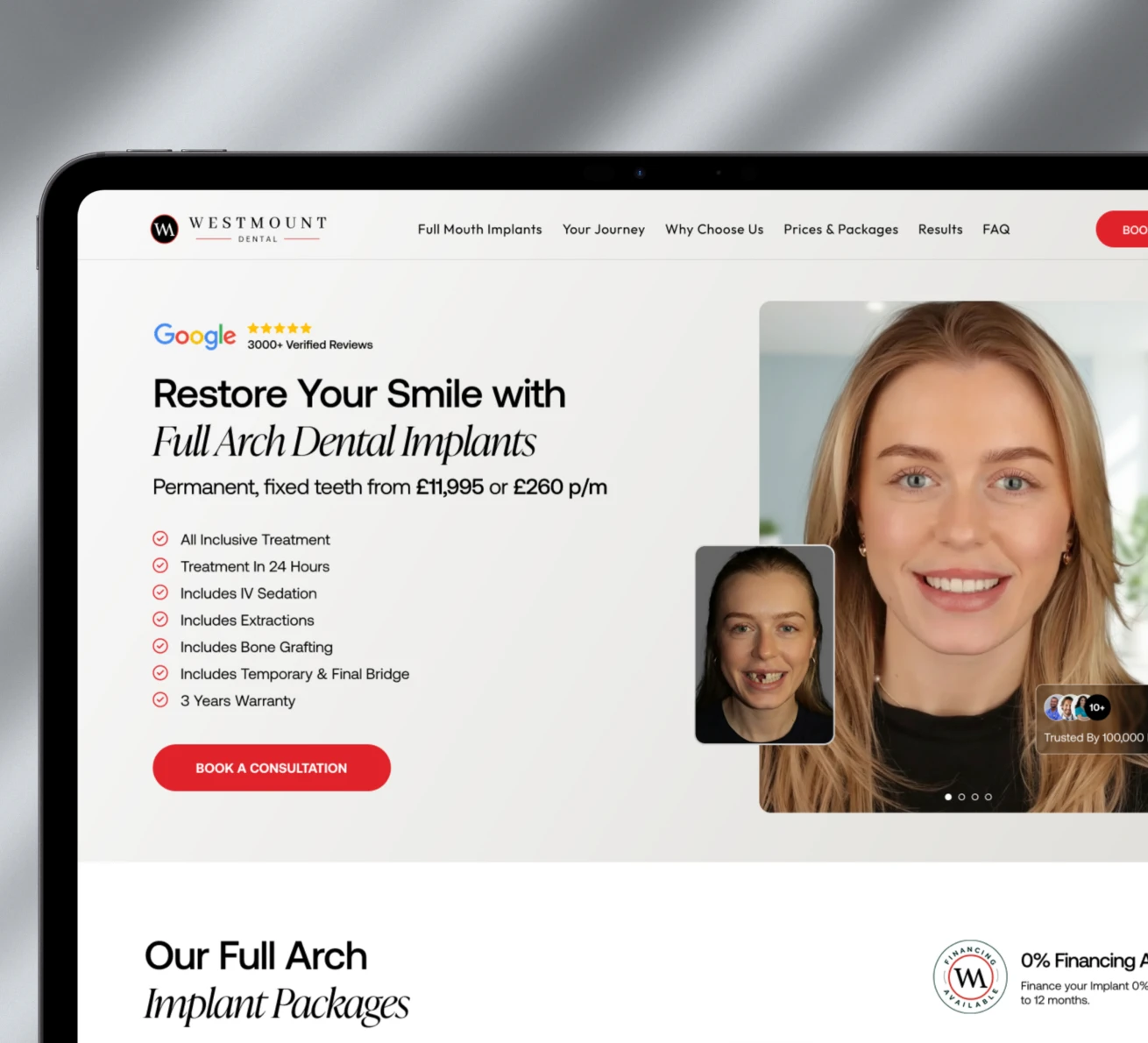 Westmount Dental consultation landing-page artwork designed by Convertt
